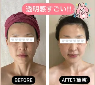 35歳からの エイジングケアサロンのエステ・リラクイメージ