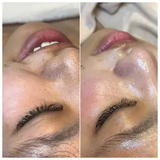 La Dusa 韓国肌管理/小波のエステ・リラクイメージ