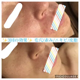 ショート カラー パーマ ヘアアレンジ メンズ キッズ ネイル マツエク・マツパ EnsorClair 代表　野口真央のエステ・リラクイメージ