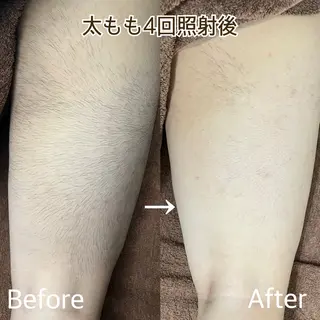 小林 千愛のエステ・リラクイメージ