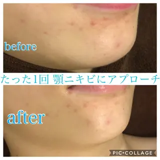 ロング カラー パーマ ヘアアレンジ メンズ キッズ ネイル マツエク・マツパ EnsorClair 代表 野口真央のエステ・リラクイメージ