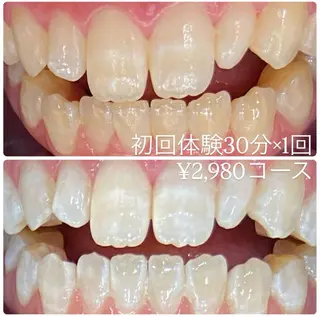 ホワイトニングルーム 横浜店のその他イメージ