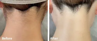 メンズ Hair Peace 脱毛サロンのエステ・リラクイメージ