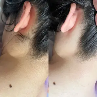 名駅🌼無痛美肌脱毛 /フェイシャルのエステ・リラクイメージ