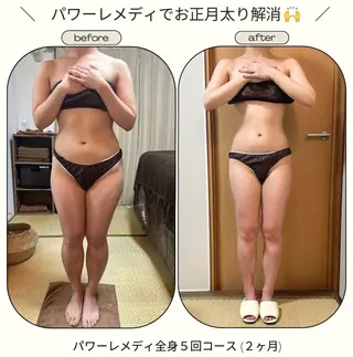 《本気痩せ×疲労改善 》  BILOOPのエステ・リラクイメージ