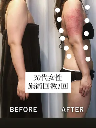 痩身・脱毛・肌管理 Rechica心斎橋のエステ・リラクイメージ