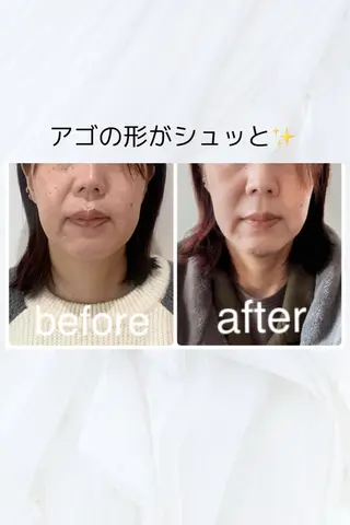小顔と ヘッドスパのお店のエステ・リラクイメージ