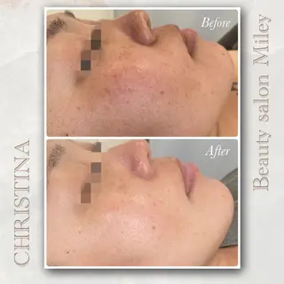 Miley/肌質改善 Megumiのエステ・リラクイメージ