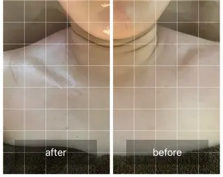 心斎橋痩身ダイエット 韓国.美容鍼.小顔のエステ・リラクイメージ