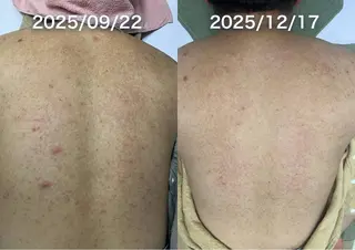 韓国美肌/肌質改善 【天神】のエステ・リラクイメージ