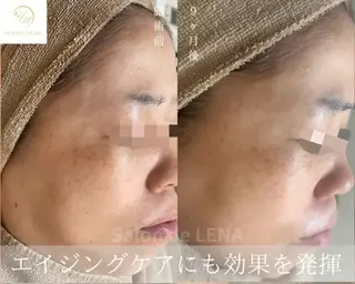 ハーブピーリング専門 グランディール　武内のエステ・リラクイメージ