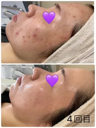 COCO beautyサロンのエステ・リラクイメージ