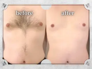 都度払い脱毛 Lino柏/Moneのエステ・リラクイメージ