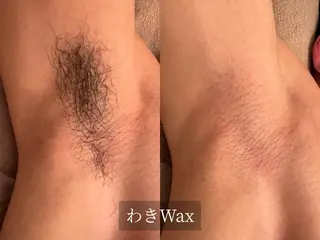 脱毛サロン Arumのエステ・リラクイメージ