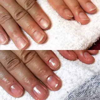 ネイル 茅ヶ崎Queen エステ/脱毛/リラクのエステ・リラクイメージ