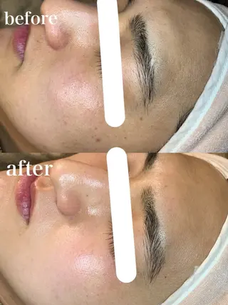 【都度払い専門】エステサロンARTI,天神大名店所属・【都度払い専門店】 エステサロARTI,のエステ・リラクイメージ