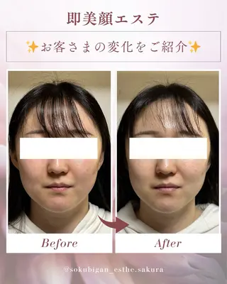 さくら｜むくみ顔専門 エステ｜銀座のエステ・リラクイメージ