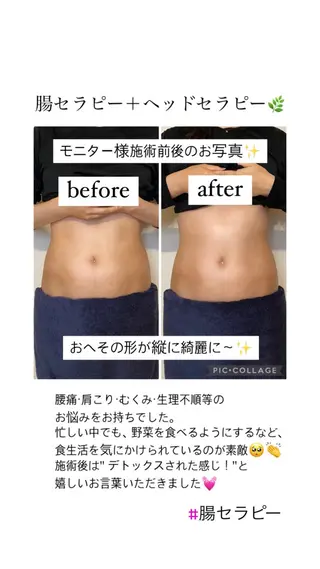 腸セラピーサロン ナチュモアのエステ・リラクイメージ