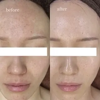 韓国肌管理・肌質改善 EARNEST心斎橋のエステ・リラクイメージ