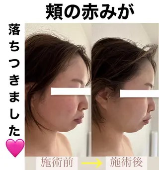 脱毛&美容サロン BLUESEAのエステ・リラクイメージ