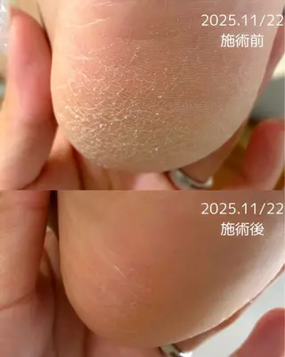 Li.m nail リム ネイルのネイルデザイン