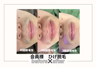 みんなの脱毛 TSURURINのエステ・リラクイメージ