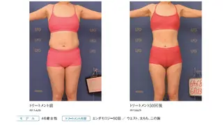 オレンジバナナ 新潟店のエステ・リラクイメージ