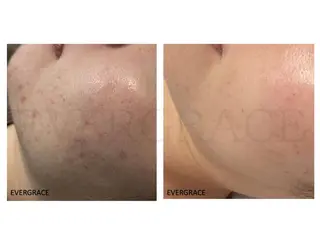 エヴァーグレース 金山店のエステ・リラクイメージ