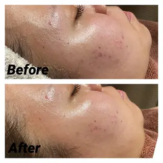 メンズ 朝重い人専用 肩甲骨調整のエステ・リラクイメージ