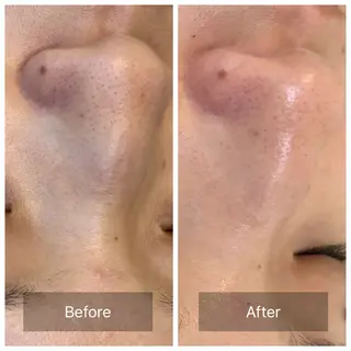 facial aesthetic salon SENTEUR所属・美肌改善/毛穴/シミ サントゥールのエステ・リラクイメージ