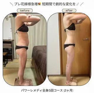 《本気痩せ×疲労改善 》  BILOOPのエステ・リラクイメージ