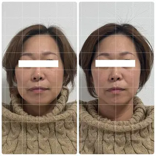 片山けいこ｜ 美人顔創りの専門家のエステ・リラクイメージ