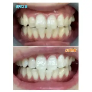 M渋谷 ホワイトニングのエステ・リラクイメージ