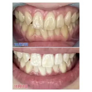 M渋谷 ホワイトニングのエステ・リラクイメージ