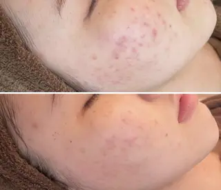 esthesalon O'-en-のエステ・リラクイメージ