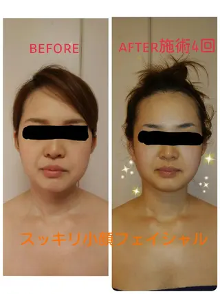 リンパサロン レディ ワンのエステ・リラクイメージ