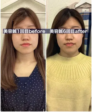 ハリサロンドオフ 美容鍼灸×小顔整体のエステ・リラクイメージ