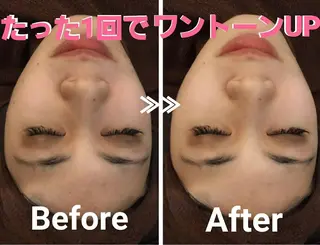 加藤 まいのエステ・リラクイメージ