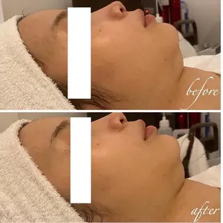 小顔マッサージ 毛穴/POLAのエステ・リラクイメージ