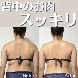 小顔矯正/骨格矯正 AKANEのエステ・リラクイメージ