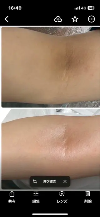 KIRAN 山﨑のエステ・リラクイメージ