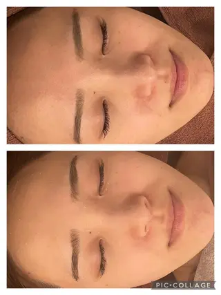 セミロング カラー パーマ ヘアアレンジ メンズ キッズ ネイル マツエク・マツパ アイブロウ 3か月で肌革命👼 ニキビ専門店💫のエステ・リラクイメージ