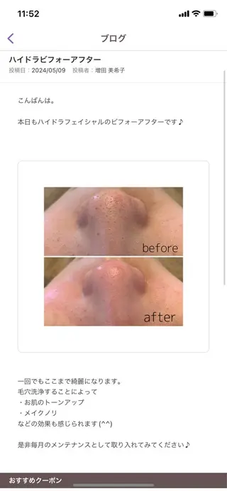 韓国肌管理 【毛穴専科】のエステ・リラクイメージ