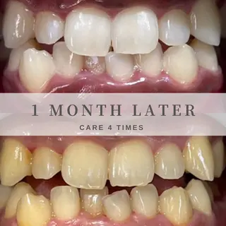 HaHaHa ホワイトニングのその他イメージ