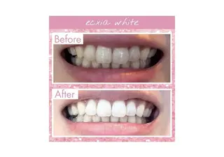 セルフホワイトニング エクシア大阪梅田店のその他イメージ