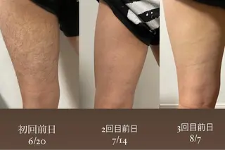 エステサロン Mi-mi.iのエステ・リラクイメージ