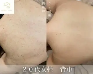 脱毛・眉毛・フェイス サロンN久留米店の眉毛・アイブロウイメージ
