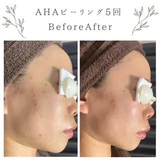 な ぎのエステ・リラクイメージ