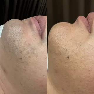 Hair Peace 脱毛サロンのエステ・リラクイメージ