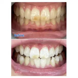 Ｍ渋谷 ホワイトニングのエステ・リラクイメージ